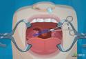 Operate Now: Tonsil Surgery screenshot 1