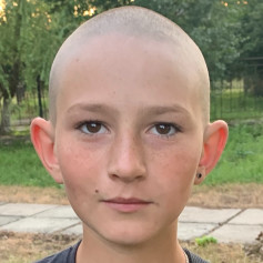 Лисий глобус